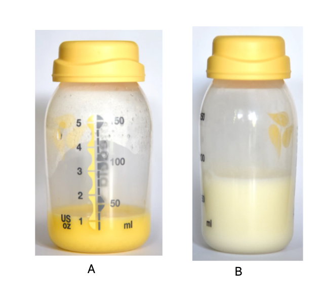 COLOSTRUM VS MATURE BREASTMILK.png