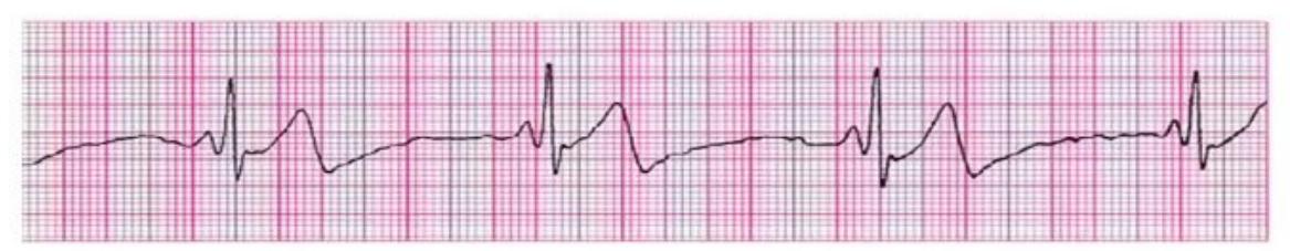 MNJ-P-OSCE 10. Advanced Life support_page_12_Figure_7.jpeg