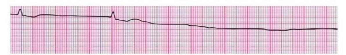 MNJ-P-OSCE 10. Advanced Life support_page_13_Figure_2.jpeg