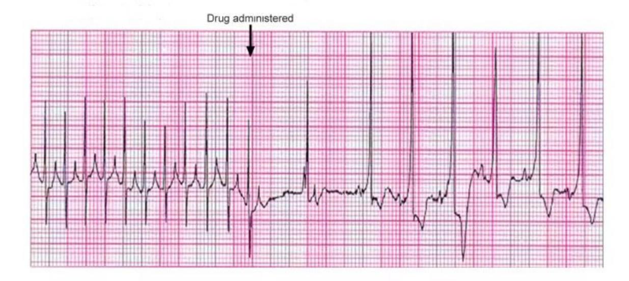 MNJ-P-OSCE 10. Advanced Life support_page_14_Figure_8.jpeg