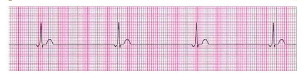 MNJ-P-OSCE 10. Advanced Life support_page_15_Figure_2.jpeg