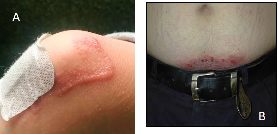 Pasted image 20260923181121.png